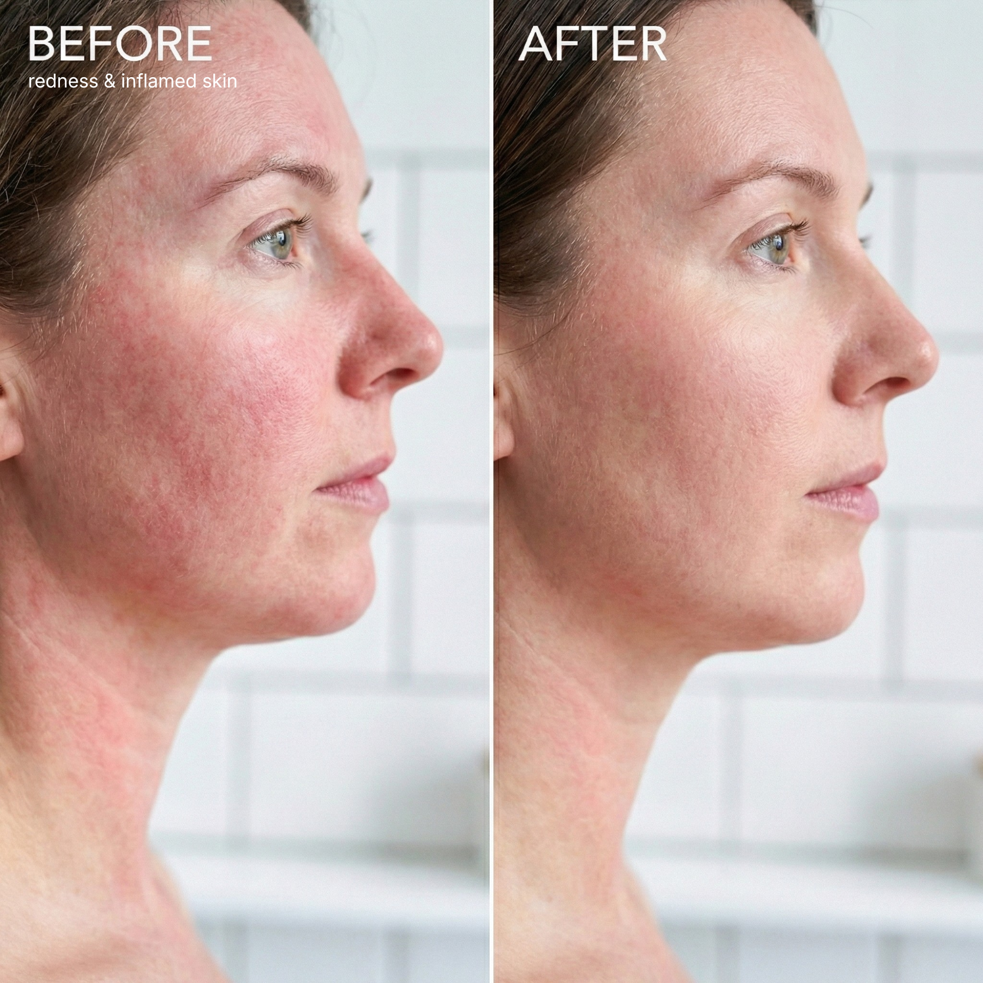 aquaflov™ PRO 3.0 Filtered Showerhead